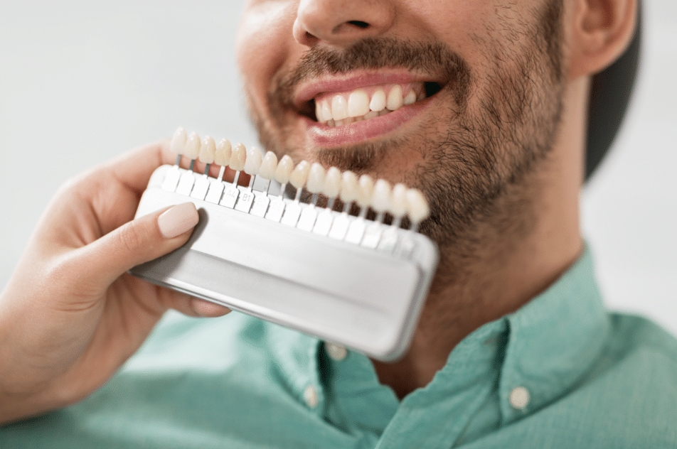 Why should you consider veneers in escondido Campbell Dental Arts dentist in escondido ca