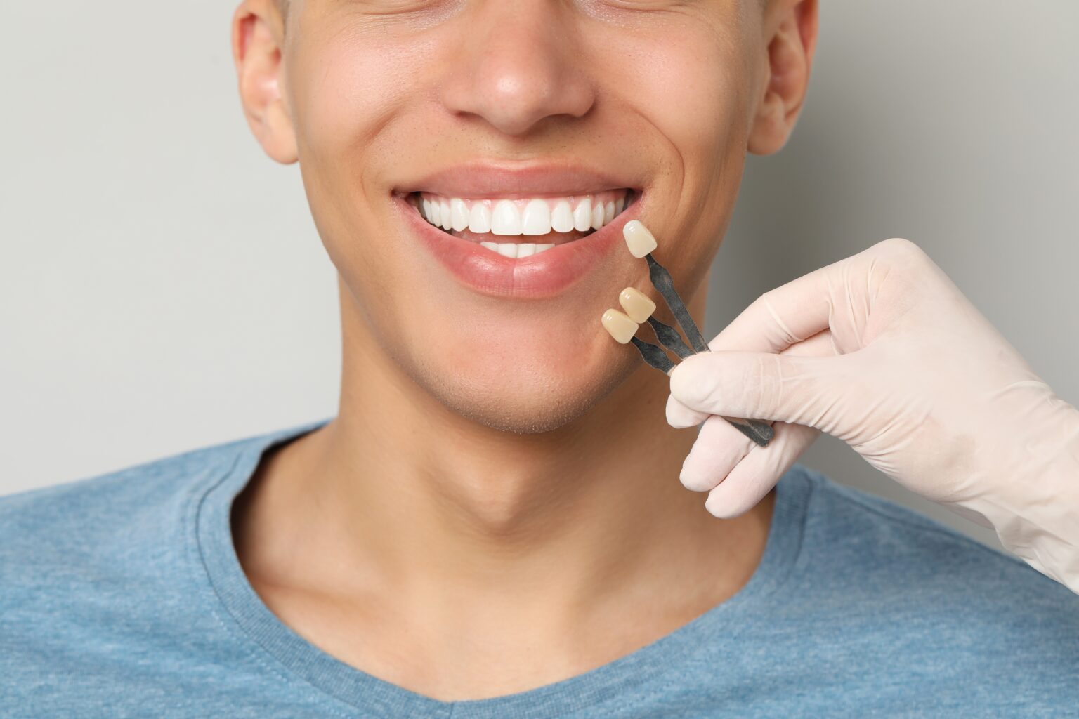 Dental Veneers Escondido