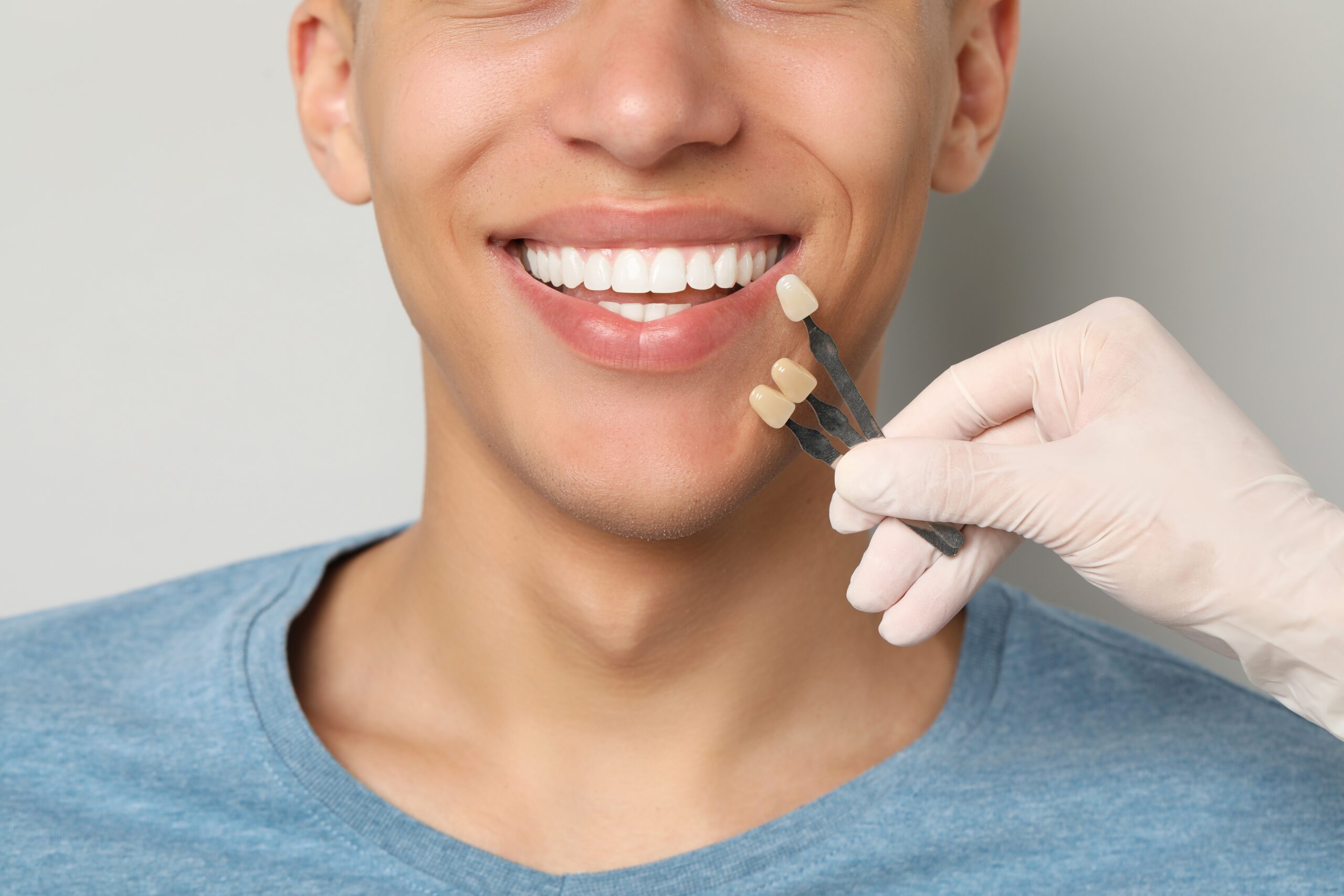 Dental Veneers Escondido